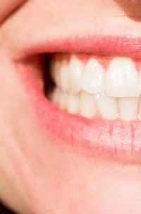 Significado de sonhar com dente podre caindo. Compreenda-o!